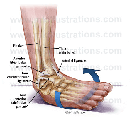 ligament on bottom of foot